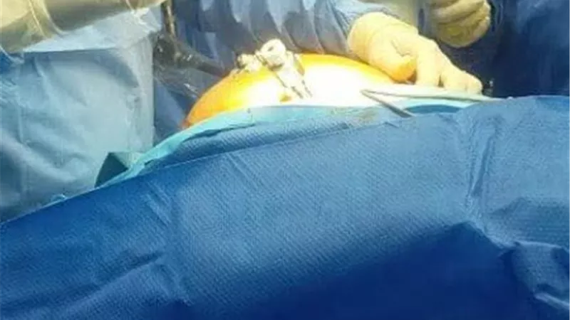  معجزة طبية تعيد الأمل لشاب.. جراحات دقيقة تنقذه من كسور معقدة بالأطراف 