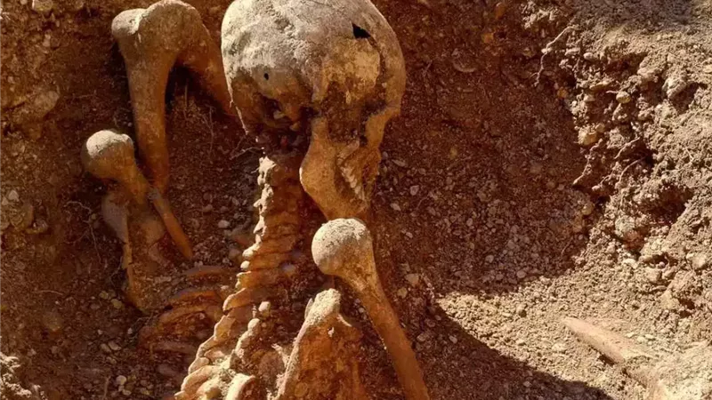 اكتشاف هياكل عظمية غريبة يثير الدهشة في ديجون الفرنسية
