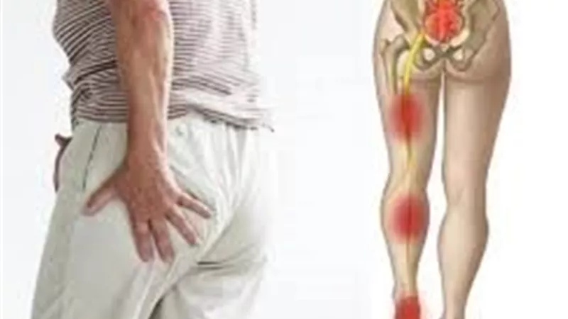 عرق النسا.. ألم يمتد من الظهر إلى الساق وكيف تتجنبه بذكاء