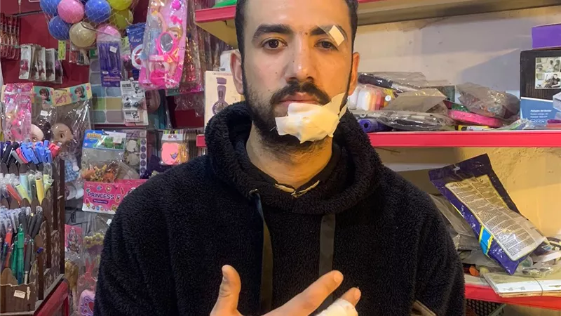 فاتورة الخير.. صاحب محل بالمرج: ساعدت سيدة في مرضها فكافأتني بـ«علقة موت»