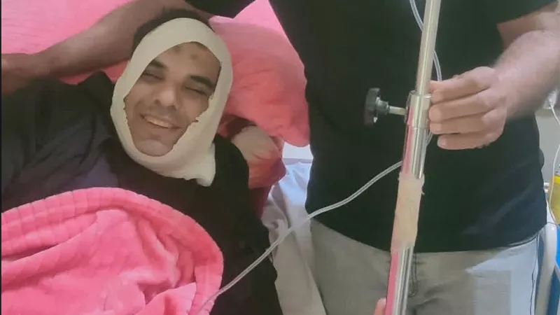بسبب 