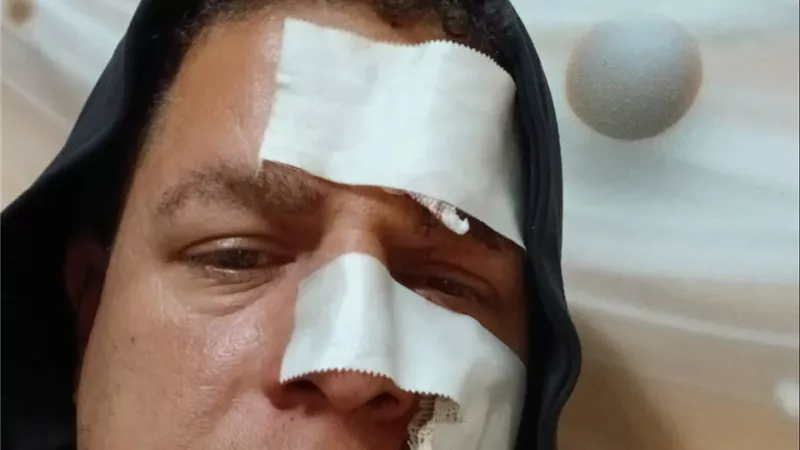 «بوظلي وشي.. وحبسه يكفيني»..معلم الدقهلية لـ«إيجبتك» بعد اعتداء طالب عليه 
