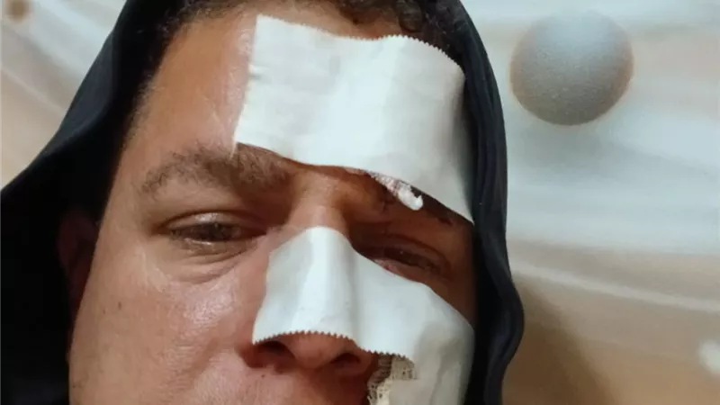 معلم الدقهلية: «مش عارف أرفع عيني.. وأطالب الوزير برد اعتباري» |خاص 