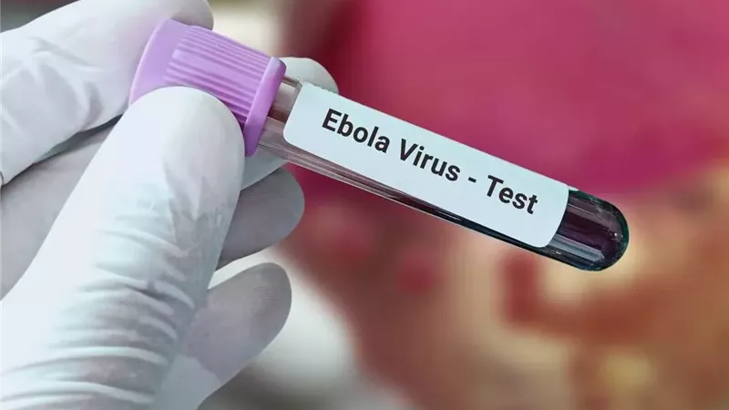 إيبولا خطره عالي.. وتحذيرات عالمية من تفش غير مسبوق بالكونغو|تقرير