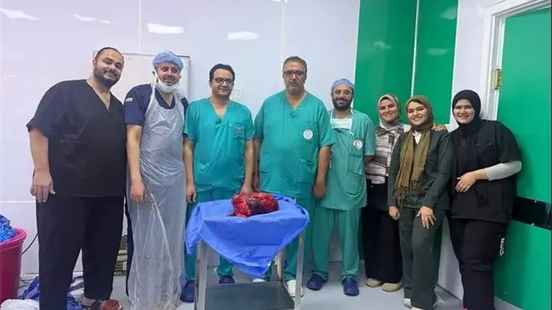  نجاح طبي نادر بجامعة المنوفية.. استئصال ورم يزن  30 كيلو من بطن شاب