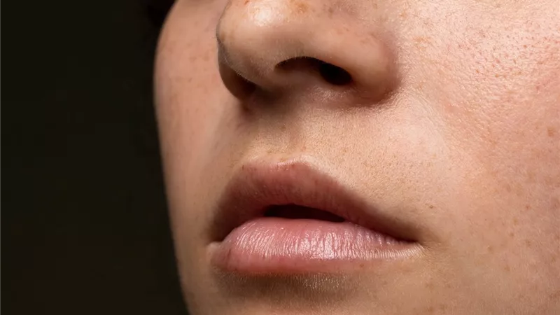 بدون خدع تجميلية.. طرق تضييق المسام الواسعة