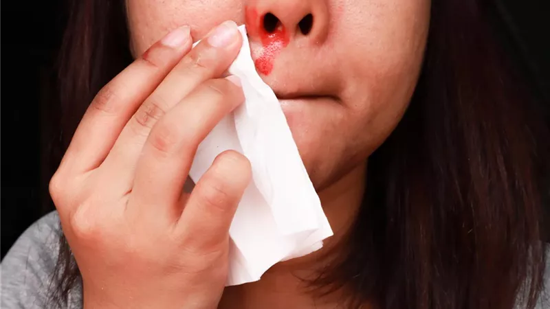 كيفية الوقاية من نزيف الأنف في الصيف