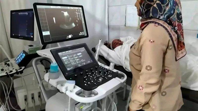 مستشفيات الدقهلية تتسلم 13 جهاز أشعة حديث بتكلفة 105 ملايين جنيه
