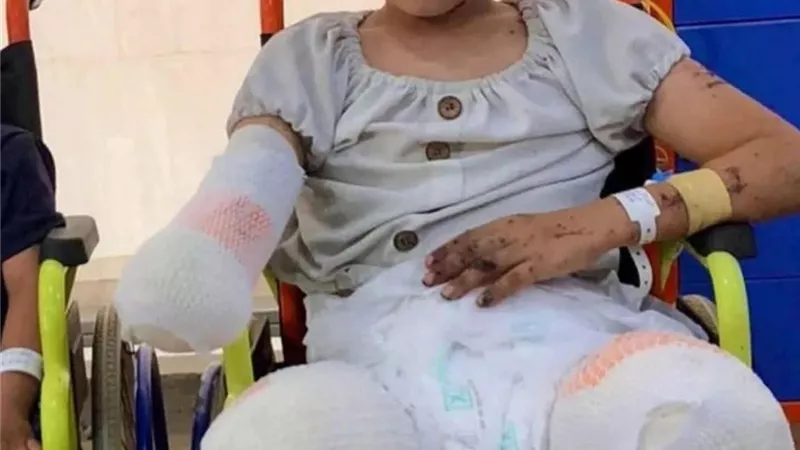 خيام من وجع.. أطفال غزة يرسمون الحياة بـ«أنامل مبتورة»