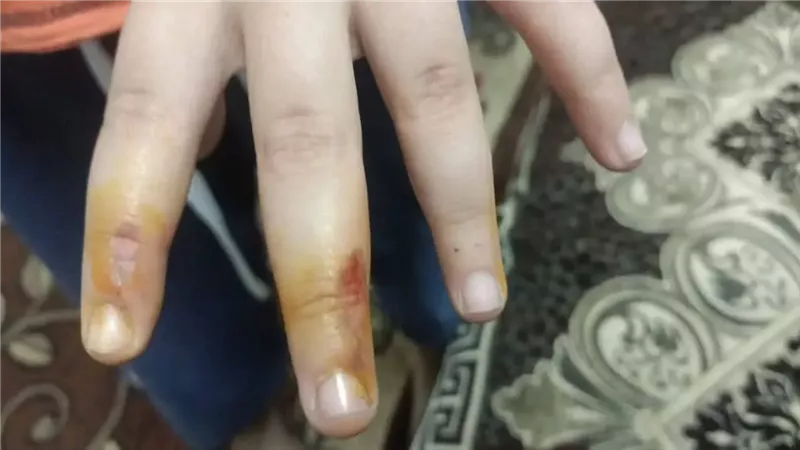 تعذيب في مدارس الحكومة.. إهانة وضرب بـ«بالعصا والخرطوم»|خاص
