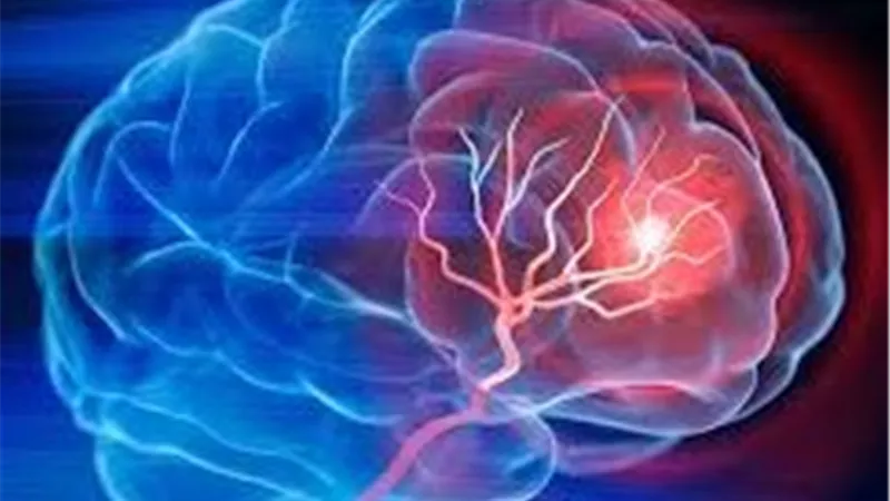 وجبات تدمر الذاكرة.. أخطر أطعمة تسبب تلف الدماغ