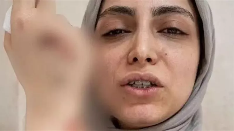 الطبيبة المعتدى عليها: رفضت تسليم الضرسين للمريضة لأن اللوائح تمنع ذلك