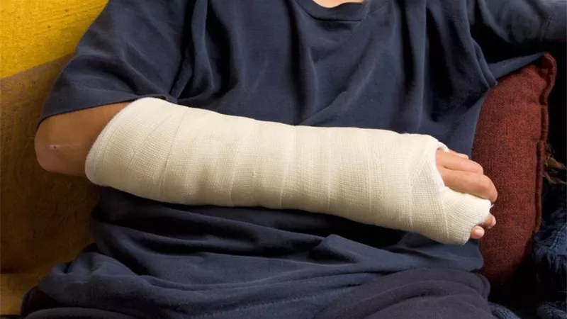 طريقة الوضوء الصحيحة مع وجود جبيرة.. تعرف عليها