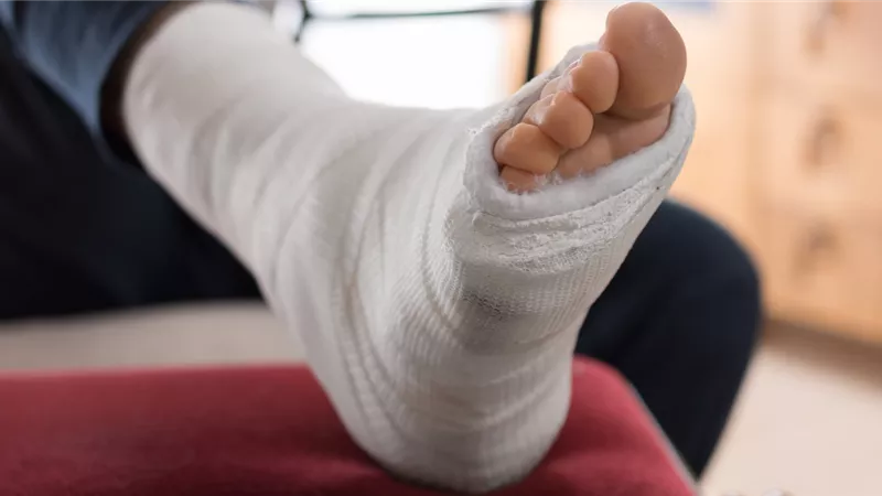 ما حكم المسح على الجبيرة في الوضوء؟.. أمين الفتوى يوضح 