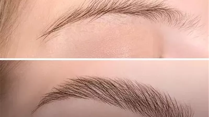ما حكم إجراء عمليات تجميل رفع الحواجب؟ دار الإفتاء تجيب 