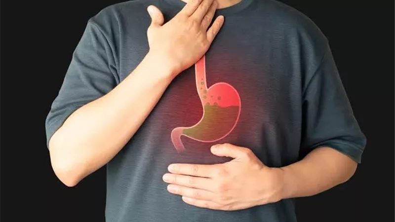  الصحة تحذر: ارتجاع المريء قد يكون مؤشرًا لمشكلة صحية تستدعي الفحص