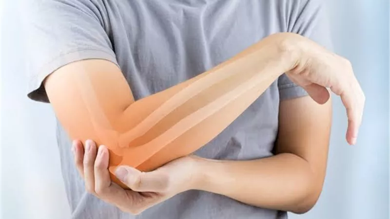 متى تستدعي إصابة العظام إجراء أشعة فورًا؟.. طبيب يكشف علامات الخطر