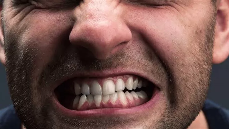 أسباب صرير الأسنان وأفضل طرق العلاج