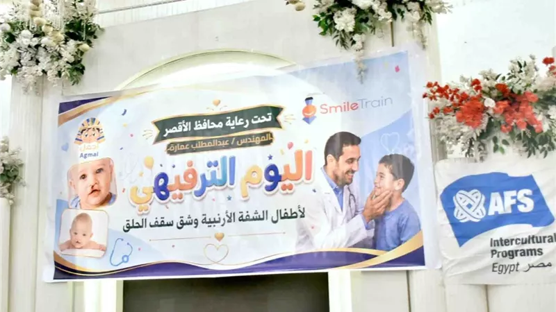 نائب محافظ الأقصر يشهد احتفالية اليوم الترفيهي لأطفال الشفة الأرنبية 