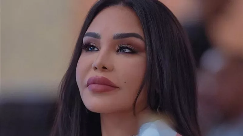 أحلام تفاجيء جمهورها بعملية تجميل وتوضح السبب