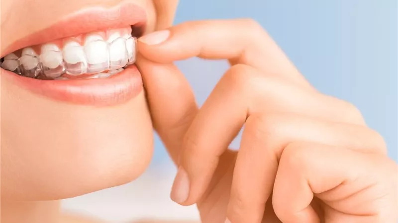 كيف تؤثر العناية بالفم والأسنان على احترام الذات؟