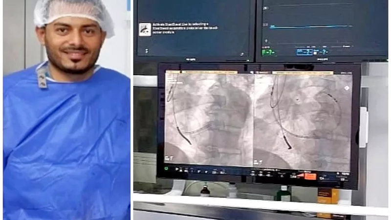 إنجاز طبي بمستشفى دسوق العام.. تركيب أول جهاز منظم لضربات القلب ثلاثي الحجرات