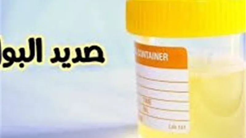 أسباب صديد البول عند الأطفال وطرق الوقاية منه