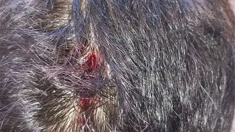 مأساة جديدة.. 3 طلاب يعتدون على زميلهم بمدرسة ميت بدر الإعدادية بالدقهلية