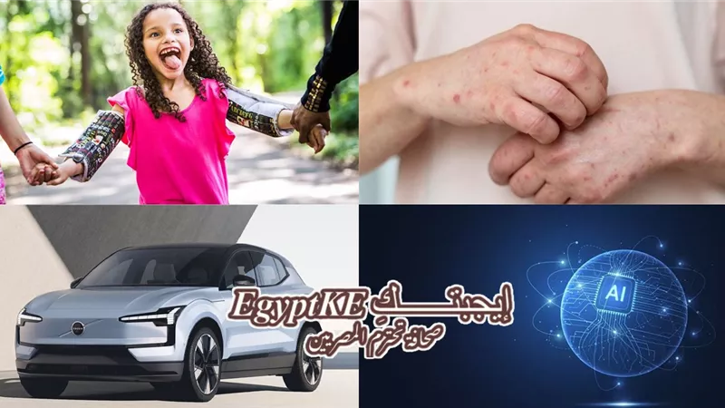 نشرة منوعات «إيجبتك».. أهم طرق الوقاية من الجديري المائي